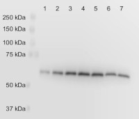 PGDH3 | Phosphoglycerate dehydrogenase 3 (chloroplastic) in the group Antibodies Plant/Algal / Malus domestica at Agrisera AB (Antibodies for research) (AS20 4391)